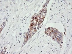 RARRES1 Monoclonal Antibody (OTI1B1), TrueMAB , OriGene 100 &mu;L; Unconjugated:Antibodies,