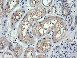 RARRES1 Monoclonal Antibody (OTI1B1), TrueMAB , OriGene 100 &mu;L; Unconjugated:Antibodies,
