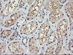 RARRES1 Mouse anti-Human, Clone: OTI1H2, lyophilized, TrueMAB 100 &mu;g;