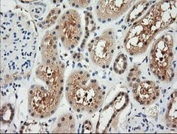 RARRES1 Monoclonal Antibody (OTI1A7), TrueMAB , OriGene 100 &mu;L; Unconjugated:Antibodies,