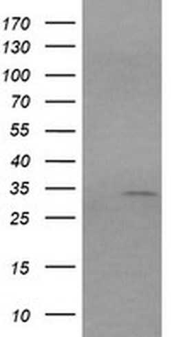 RARRES1 Monoclonal Antibody (OTI1C9), TrueMAB , OriGene 100 &mu;L; Unconjugated:Antibodies,