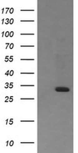 RARRES1 Monoclonal Antibody (OTI1A6), TrueMAB , OriGene:Antibodies:Primary