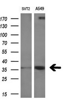 RARRES1 Monoclonal Antibody (OTI1B1), TrueMAB , OriGene:Antibodies:Primary
