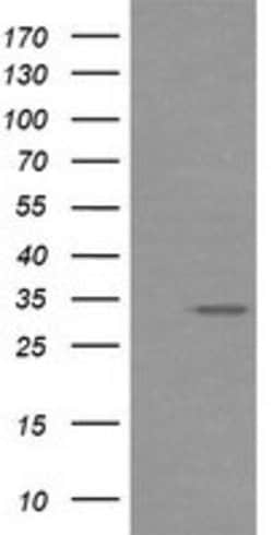 RARRES1 Mouse anti-Human, Clone: OTI1H2, lyophilized, TrueMAB 100 &mu;g;