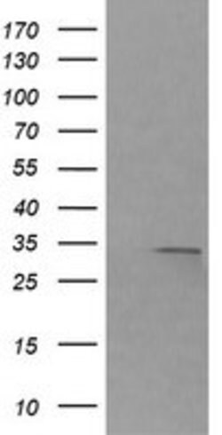 RARRES1 Mouse anti-Canine, Human, Mouse, Rat, Clone: OTI1B3, lyophilized,