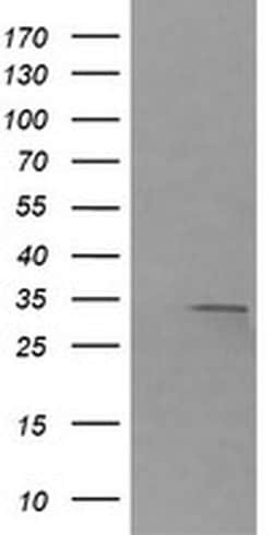 RARRES1 Mouse anti-Canine, Human, Mouse, Rat, Clone: OTI1B3, liquid, TrueMAB