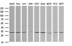 RARRES1 Mouse anti-Canine, Human, Mouse, Rat, Clone: OTI1B3, lyophilized,