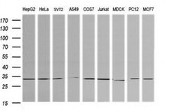 RARRES1 Mouse anti-Canine, Human, Mouse, Rat, Clone: OTI1B3, liquid, TrueMAB