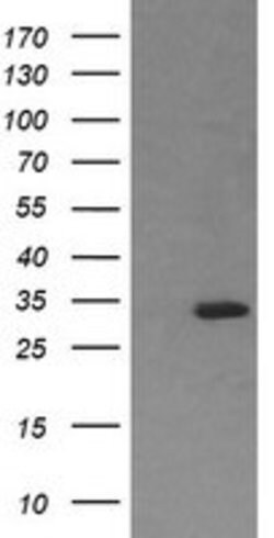 RARRES1 Mouse anti-Human, Clone: OTI1B8, lyophilized, TrueMAB 100 &mu;g | Buy Online | OriGene | Fisher Scientific