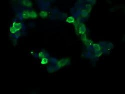 RASA1 Mouse anti-Human, Clone: OTI1H2, lyophilized, TrueMAB 100 &mu;g;