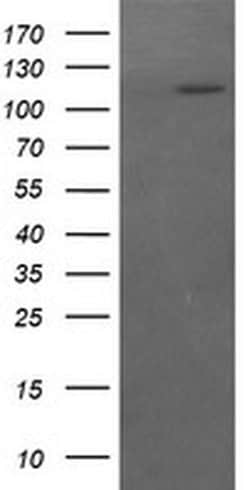 RASA1 Monoclonal Antibody (OTI2H1), TrueMAB , OriGene 100 &mu;L; Unconjugated:Antibodies,