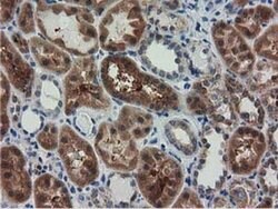 RASD2 Monoclonal Antibody (OTI1G1), TrueMAB , OriGene 100 &mu;L; Unconjugated:Antibodies,