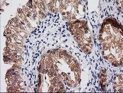 RASSF1 Mouse anti-Human, Clone: OTI2B11, lyophilized, TrueMAB 100 &mu;g;