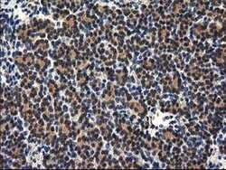 RASSF1 Mouse anti-Human, Clone: OTI2B11, lyophilized, TrueMAB 100 &mu;g;