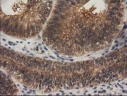 RASSF1 Mouse anti-Human, Clone: OTI2B11, lyophilized, TrueMAB 100 &mu;g;