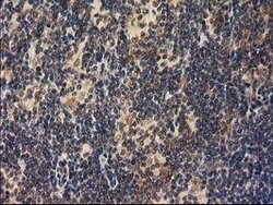 RASSF1 Mouse anti-Human, Clone: OTI2B11, lyophilized, TrueMAB 100 &mu;g;