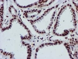 RASSF1 Mouse anti-Human, Clone: OTI8E4, lyophilized, TrueMAB 100 &mu;g;