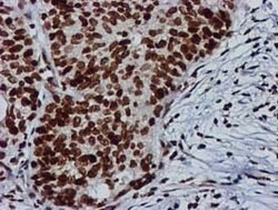 RASSF1 Mouse anti-Human, Clone: OTI8E4, lyophilized, TrueMAB 100 &mu;g;