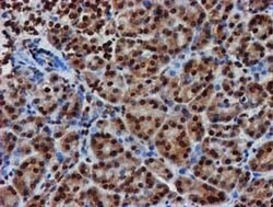 RASSF1 Mouse anti-Human, Clone: OTI8E4, lyophilized, TrueMAB 100 &mu;g;