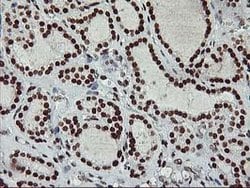 RASSF1 Mouse anti-Human, Clone: OTI8E4, lyophilized, TrueMAB 100 &mu;g;
