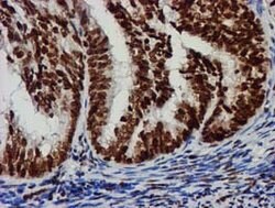 RASSF1 Mouse anti-Human, Clone: OTI8E4, lyophilized, TrueMAB 100 &mu;g;