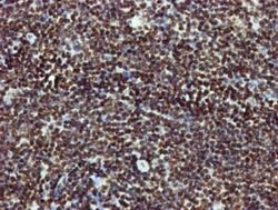 RASSF1 Mouse anti-Human, Clone: OTI8E4, lyophilized, TrueMAB 100 &mu;g;