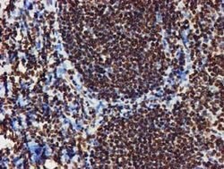 RASSF1 Mouse anti-Human, Clone: OTI8E4, lyophilized, TrueMAB 100 &mu;g;