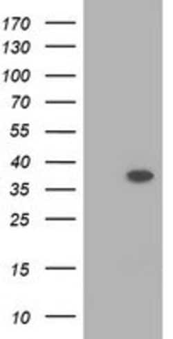 RASSF1 Mouse anti-Human, Clone: OTI2B11, lyophilized, TrueMAB 100 &mu;g;