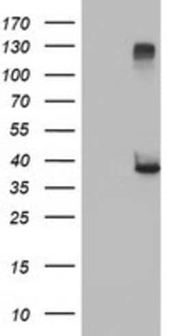 RASSF1 Mouse anti-Human, Clone: OTI8E4, lyophilized, TrueMAB 100 &mu;g;