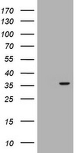 RASSF5 Monoclonal Antibody (OTI1C6), TrueMAB , OriGene 100 &mu;L; Unconjugated:Antibodies,