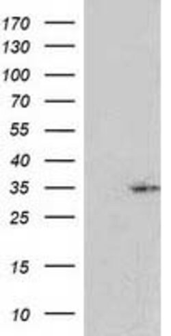 RASSF5 Mouse anti-Human, Clone: OTI1A11, lyophilized, TrueMAB 100 &mu;g;