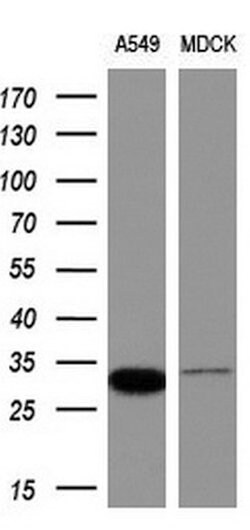 RASSF5 Mouse anti-Human, Clone: OTI1A11, lyophilized, TrueMAB 100 &mu;g;