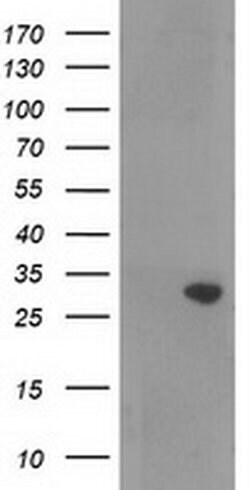 RASSF5 Monoclonal Antibody (OTI1H2), TrueMAB , OriGene 100 &mu;L; Unconjugated:Antibodies,