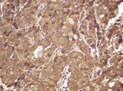 RASSF8 Monoclonal Antibody (OTI2B6), TrueMAB , OriGene 100 &mu;L; Unconjugated:Antibodies,