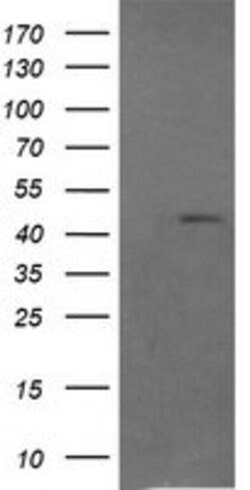 RASSF8 Mouse anti-Human, Clone: OTI1F12, lyophilized, TrueMAB 100 &mu;g;