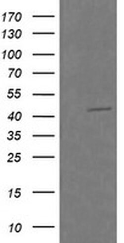 RASSF8 Monoclonal Antibody (OTI2F9), TrueMAB , OriGene 100 &mu;L; Unconjugated:Antibodies,
