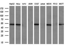 RASSF8 Monoclonal Antibody (OTI1A1), TrueMAB , OriGene 100 &mu;L; Unconjugated:Antibodies,