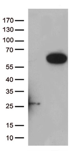 RASSF9 Monoclonal Antibody (OTI5E5), TrueMAB , OriGene:Antibodies:Primary
