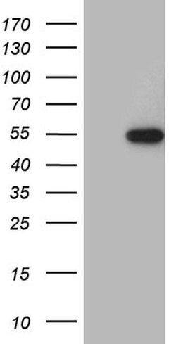 RAX Monoclonal Antibody (OTI1C5), TrueMAB , OriGene 30 &mu;L; Unconjugated:Antibodies,