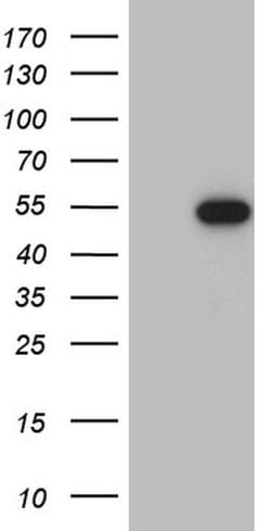 RAX Monoclonal Antibody (OTI5C10), TrueMAB , OriGene:Antibodies:Primary