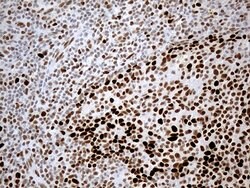 RB1 Monoclonal Antibody (OTI11C10), TrueMAB , OriGene 100 &mu;L; Unconjugated:Antibodies,