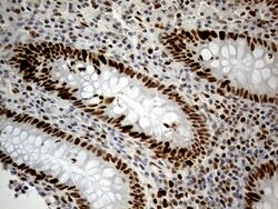 RB1 Monoclonal Antibody (OTI11C10), TrueMAB , OriGene 100 &mu;L; Unconjugated:Antibodies,