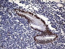 RB1 Mouse anti-Human, Clone: OTI13A6, lyophilized, TrueMAB 100 &mu;g; Unconjugated:Antibodies,