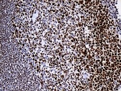 RB1 Mouse anti-Human, Clone: OTI13A6, lyophilized, TrueMAB 100 &mu;g; Unconjugated:Antibodies,