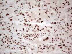 RB1 Monoclonal Antibody (OTI3F11), TrueMAB , OriGene 100 &mu;L; Unconjugated:Antibodies,