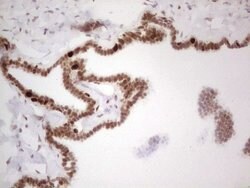 RB1 Monoclonal Antibody (OTI3F11), TrueMAB , OriGene:Antibodies:Primary