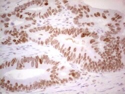 RB1 Monoclonal Antibody (OTI3F11), TrueMAB , OriGene 100 &mu;L; Unconjugated:Antibodies,