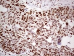 RB1 Monoclonal Antibody (OTI3F11), TrueMAB , OriGene 100 &mu;L; Unconjugated:Antibodies,