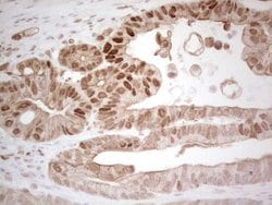 RB1 Monoclonal Antibody (OTI10H9), TrueMAB , OriGene 30 &mu;L; Unconjugated:Antibodies,