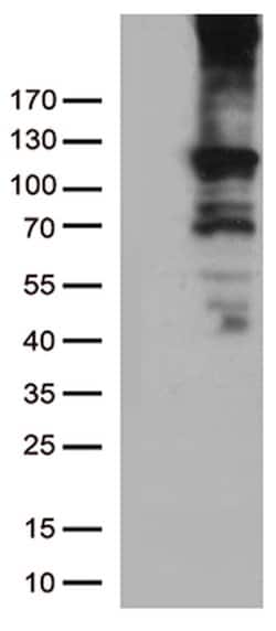 RB1 Monoclonal Antibody (OTI11C10), TrueMAB , OriGene 100 &mu;L; Unconjugated:Antibodies,